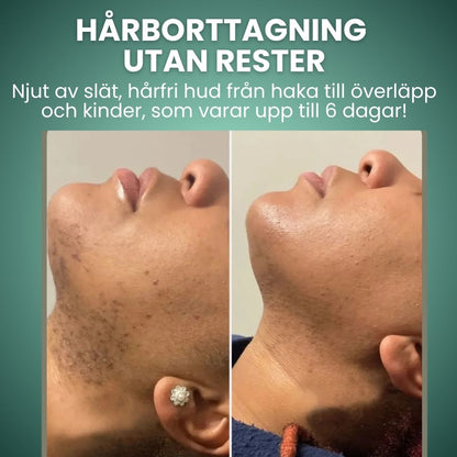 Norellee-Hårborttagningskräm-Ansikte