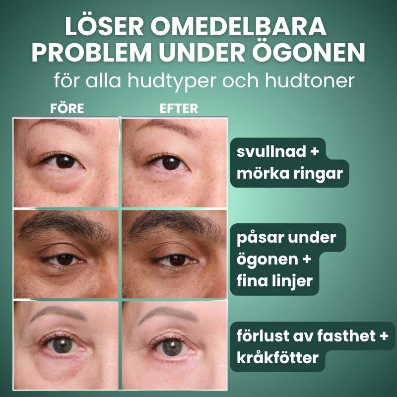 Norellee Foundation | Synligt utjämnar rynkor på bara 2 minuter – strålande hud som varar hela dagen!