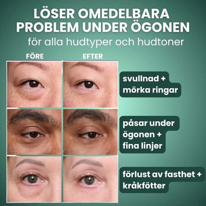 Norellee Foundation | Synligt utjämnar rynkor på bara 2 minuter – strålande hud som varar hela dagen!