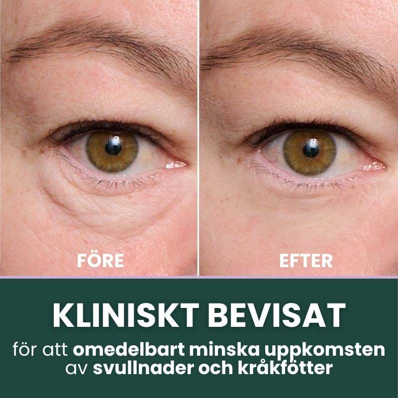 Norellee Foundation | Synligt utjämnar rynkor på bara 2 minuter – strålande hud som varar hela dagen!