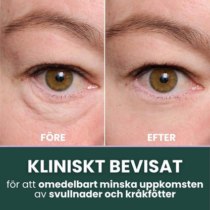 Norellee Foundation | Synligt utjämnar rynkor på bara 2 minuter – strålande hud som varar hela dagen!